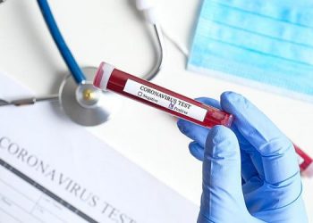 Κορωνοϊός: Στους 114 οι νεκροί -Εχασε τη μάχη 68χρονη από την Καστοριά