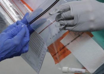 To ΕΚΠΑ παίρνει θέση για τα τεστ αντισωμάτων για τον κορωνοϊό