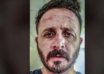 Καταπέλτης γιατρός του ΠΑΓΝΗ: Γκρινιάζετε για τις μάσκες κι εμείς δεν έχουμε!