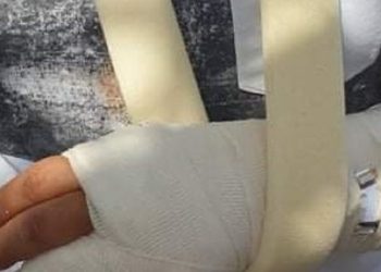 Θέμα voucherergasia.gr: Θύελλα αντιδράσεων έχει προκαλέσει η επίθεση με λοστό σε οδηγό τουριστικού λεωφορείου! (φωτογραφίες)